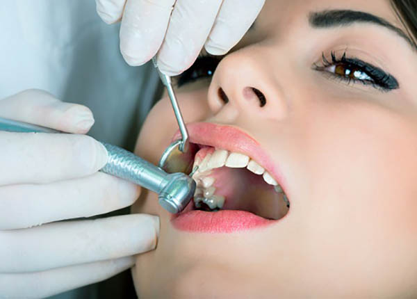 Định kỳ kiểm tra sức khỏe miệng phòng ngừa hôi miệng