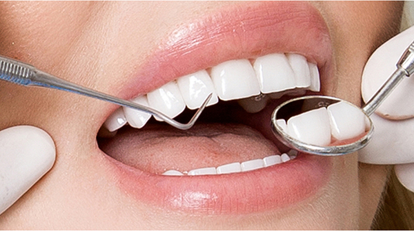 Lựa chọn nha sĩ chuyên nghiệp khi bọc răng sứ