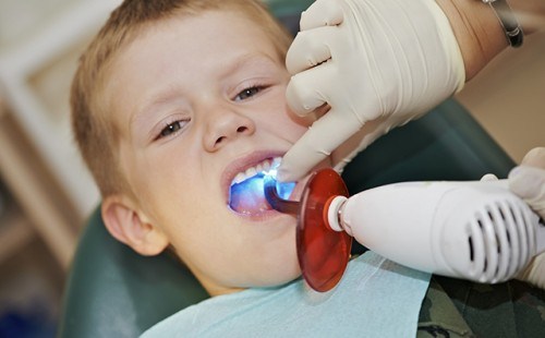 Cho trẻ lấy cao răng định kỳ và hỏi ý kiến bác sĩ nếu muốn răng con trắng hơn