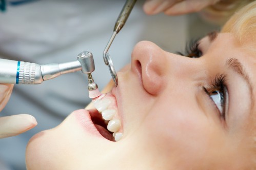 Cạo vôi răng giúp răng trắng sáng và ngăn ngừa các bệnh răng miệng