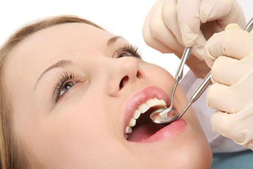 Chăm sóc răng miệng định kì tại cơ sở Nha khoa uy tín là 1 cách chữa hôi miệng hiệu quả