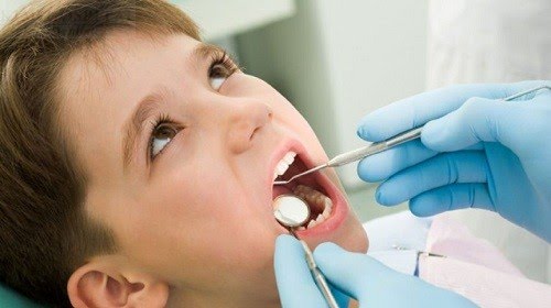 Hỏng răng miệng trẻ do thở bằng miệng