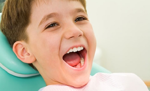 Tẩy trắng răng cho trẻ nên hay không?