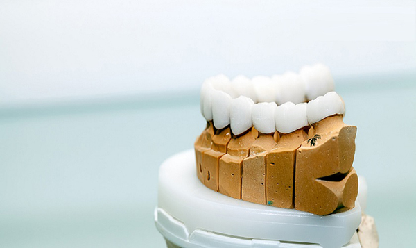 Trồng răng sứ cần lưu ý điều gì để sở hữu hàm răng đẹp