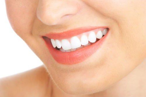 Tẩy trắng răng đem lại tính thẩm mỹ caon hưng không phải ai cũng thực hiện được