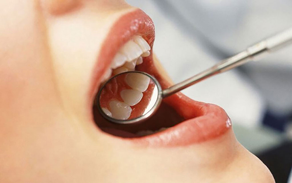 Khám răng miệng định kỳ nhằm phòng ngừa bệnh nha chu
