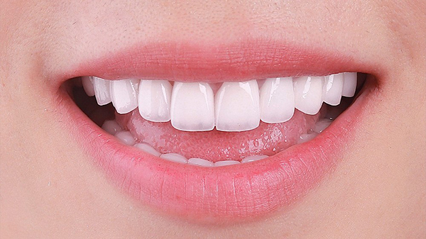 Cạo vôi răng giúp phòng ngừa vấn đề nhiễm trùng nghiêm trọng