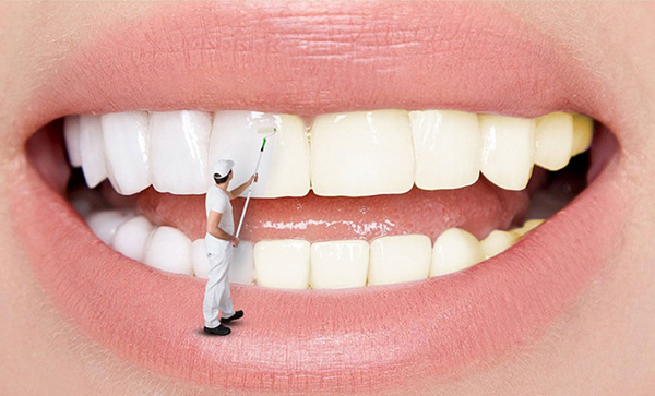 Phương pháp tẩy trắng răng tại nhà đang được nhiều người lựa chọn
