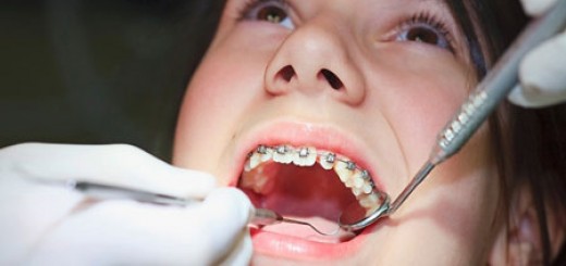 Cha mẹ nên đưa trẻ đến địa chỉ uy tín để niềng răng