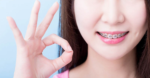 Niềng răng mang đến nụ cười tươi tắn và cải thiện chức năng của răng