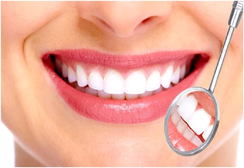 Răng màu trắng tự nhiên là màu sắc lý tưởng cho răng